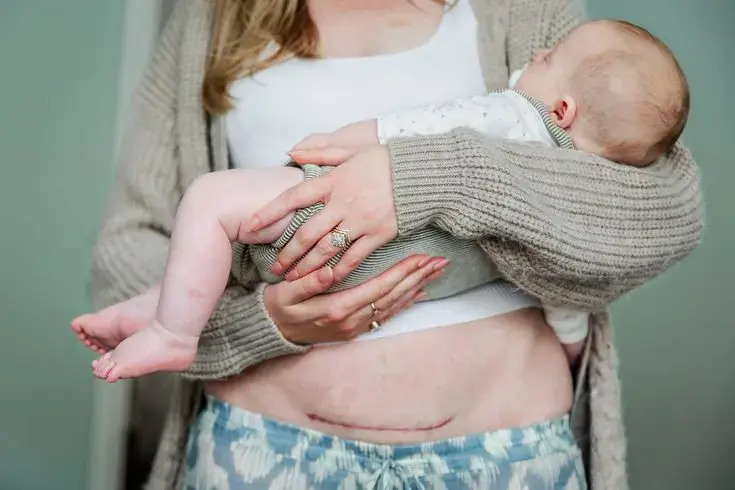Postpartum Rejuvenation Therapy